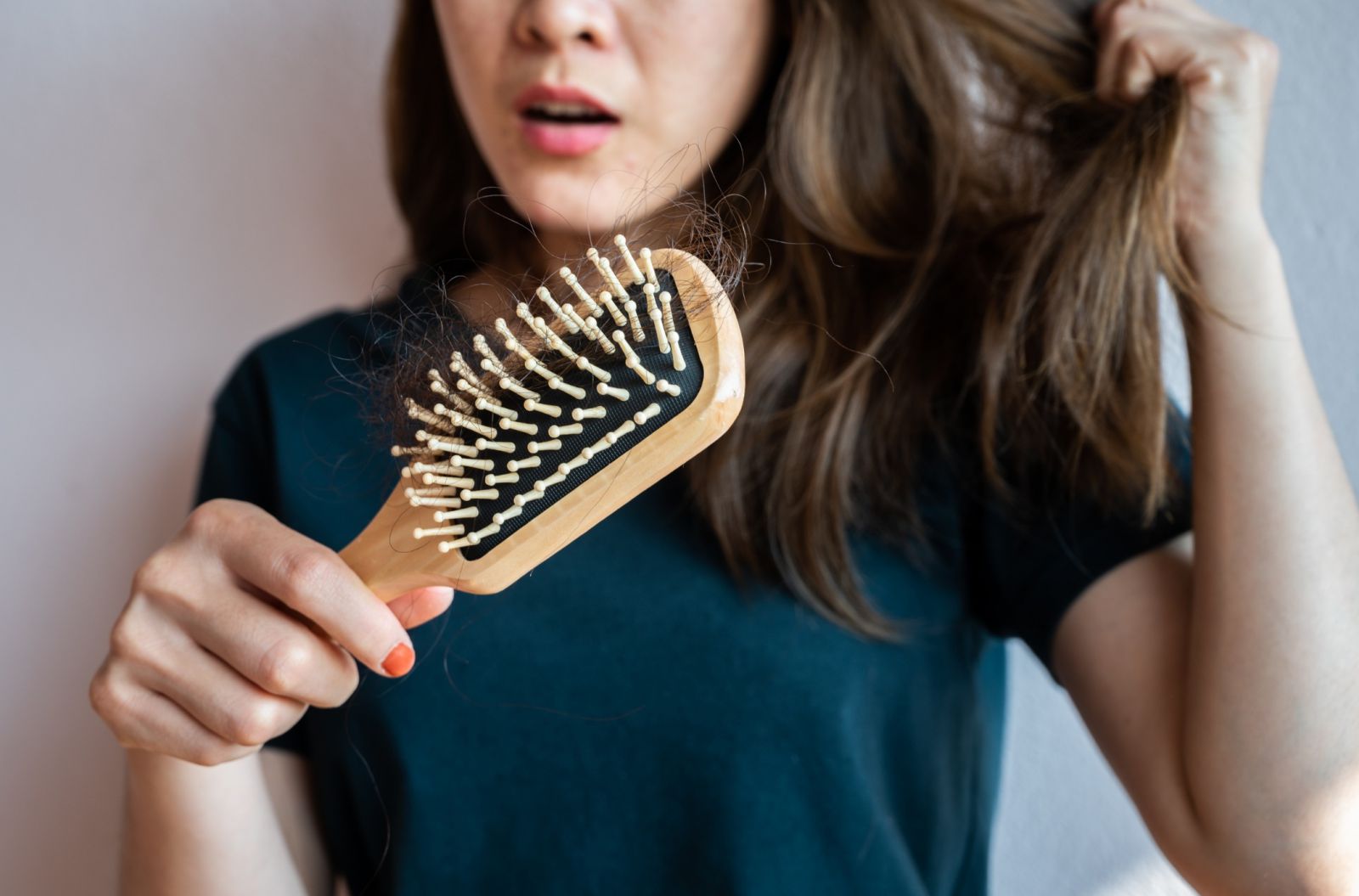 Tóc rụng, tóc bạc ở phụ nữ trung niên