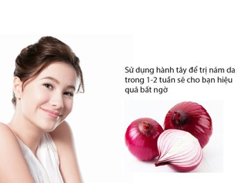 Trị nám da với hành tây