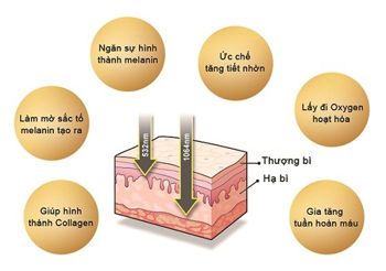 Bạn đã thực hiện theo đúng hướng dẫn trong quy trình trị nám của mình chưa?