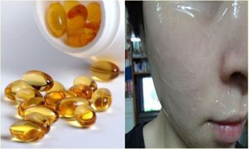 Bôi trực tiếp vitamin E lên da, giúp giảm nám nhanh chóng