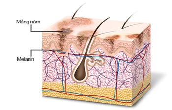 Melanin là một loại sắc tố được gọi là Melanocytes